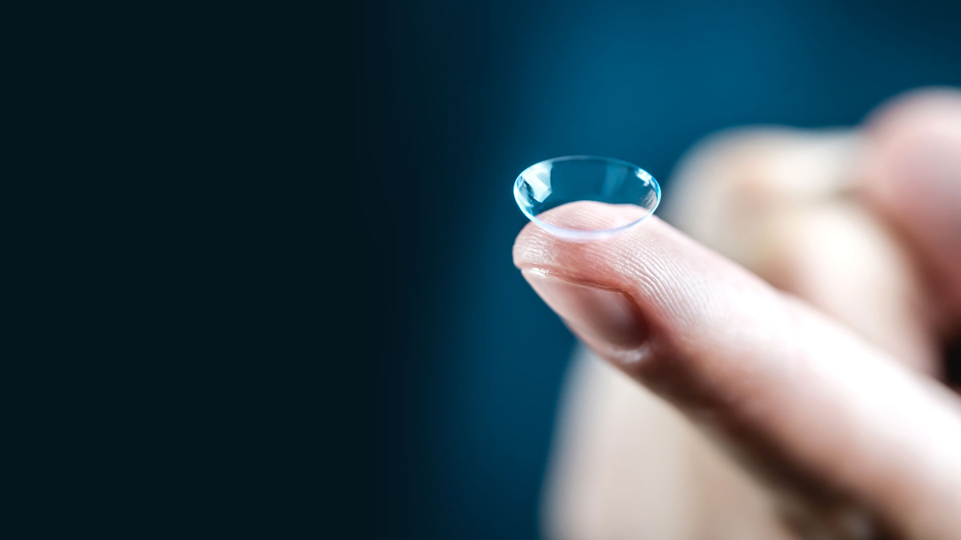 Contacts